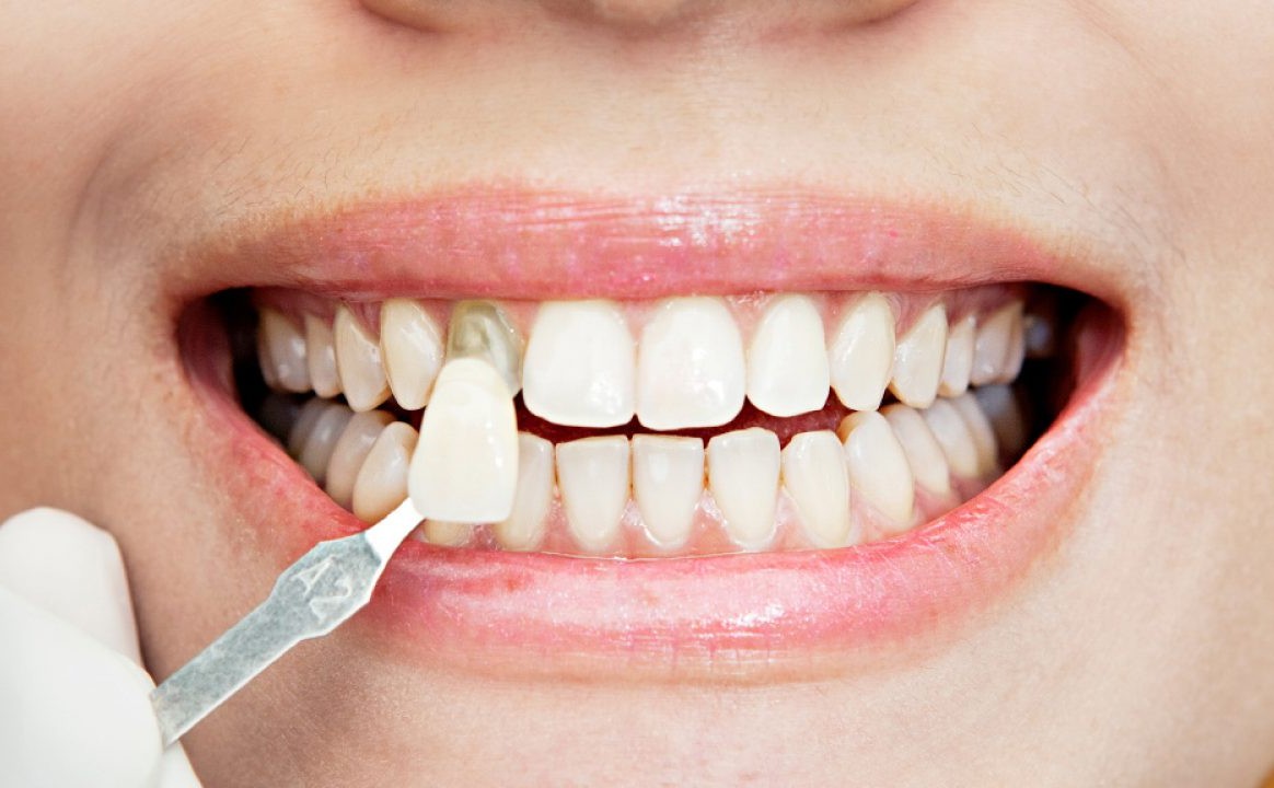 tratamiento-botox-Clinica_Innovare